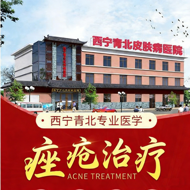 西宁痤疮科排名榜:揭秘痤疮的真相与治疗